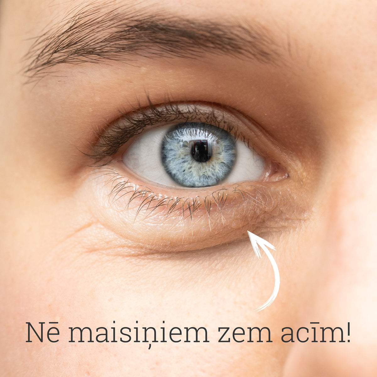 Prettūskas gels acu zonai (Anti eye-bags gel), 15ml